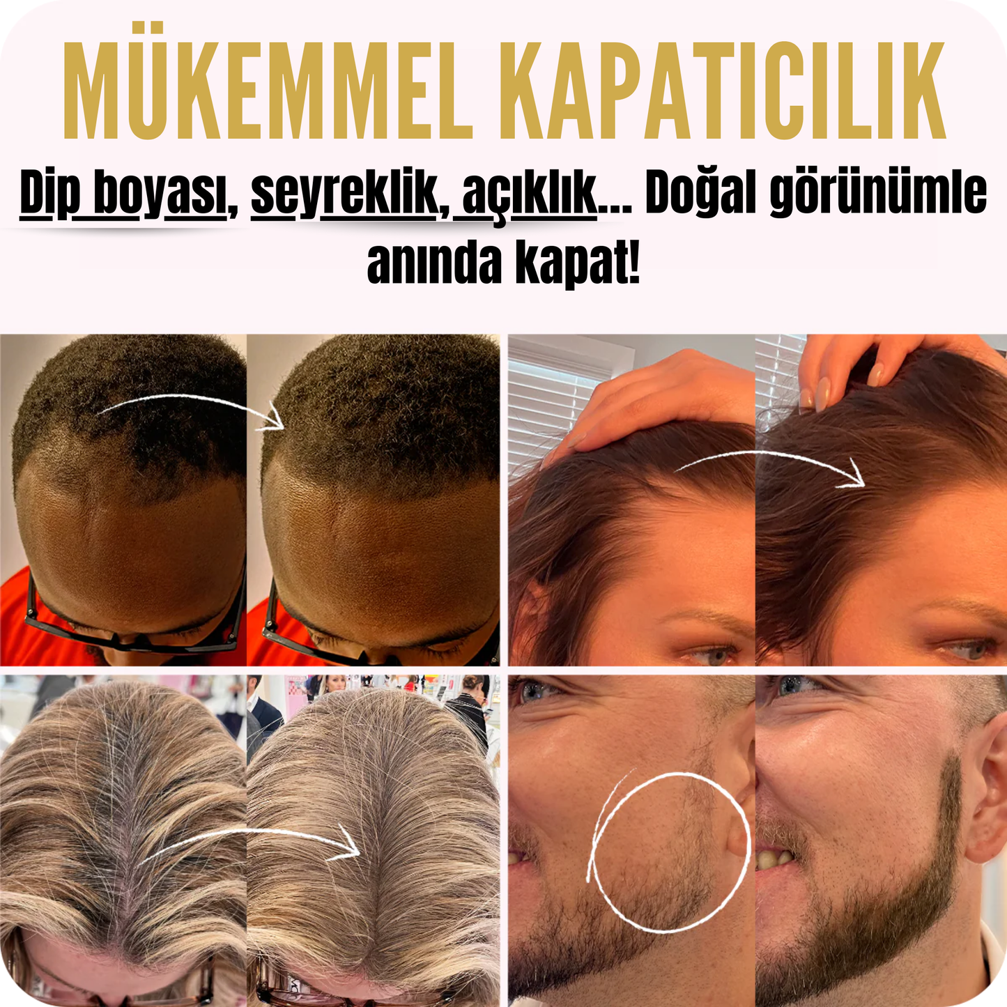 Ponipo™ Saç Pudrası